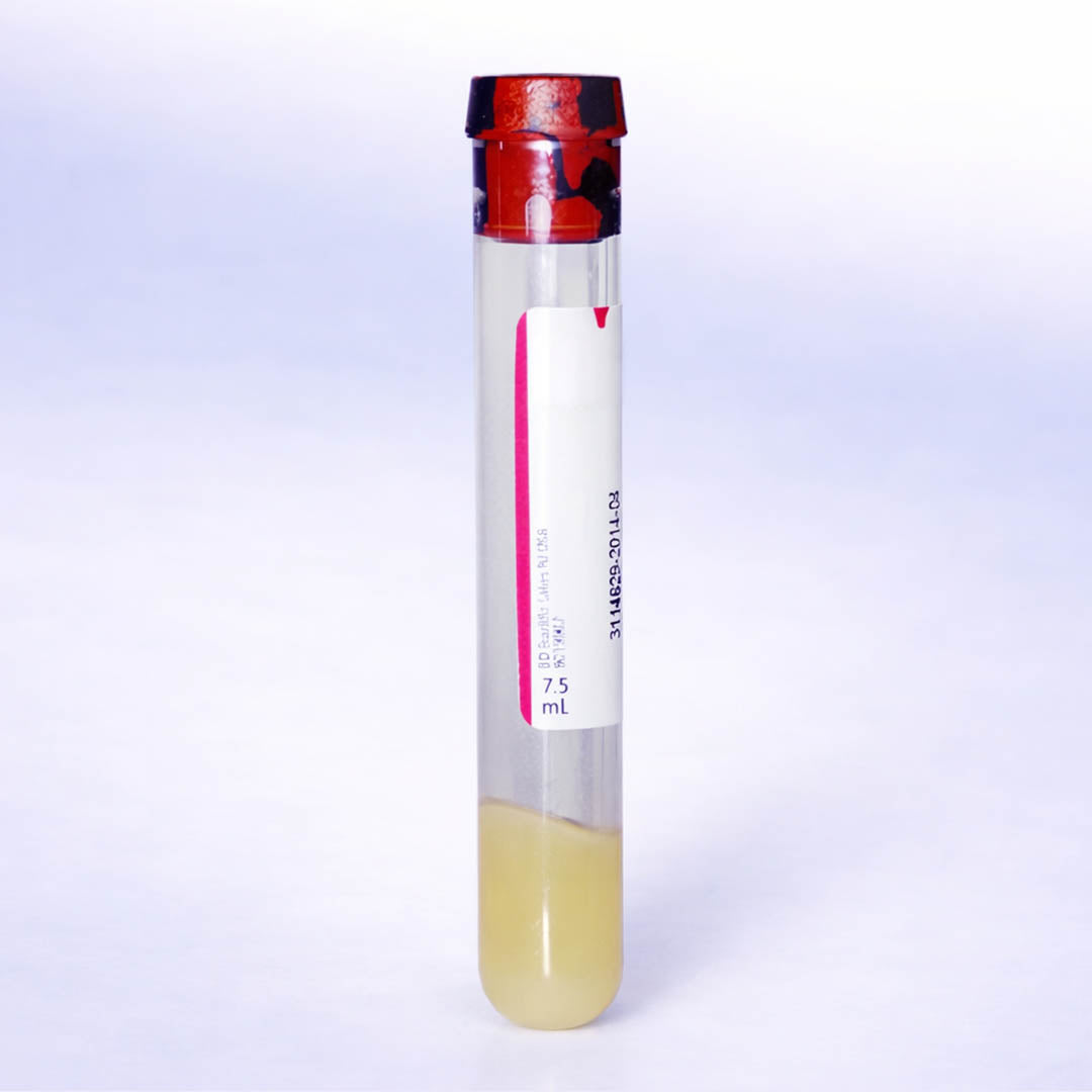 Tube Separator Serum 16x100 Sil Coated 9.0 Draw 100/BX 500/CS