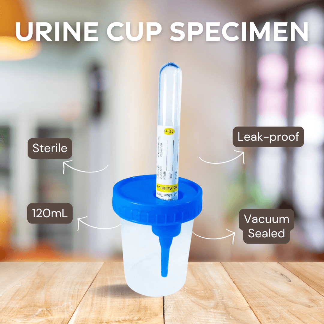 Why the 120ml Urine Collection Cup with Vacuum Needle – Sterile & Leak-Proof Is Essential for Safe Sample Handling