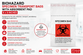 What Happens If a Specimen Leaks During Transport? Why Absorbent Pad Biohazard Bags Are Essential for Safe Specimen Handling