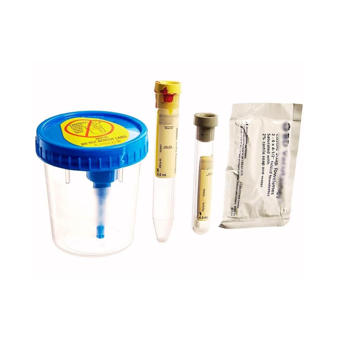 8mL Urine Analysis Tube – 16x100mm